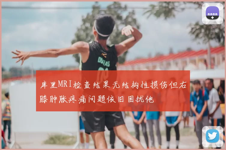 库里MRI检查结果无结构性损伤但右膝肿胀疼痛问题依旧困扰他