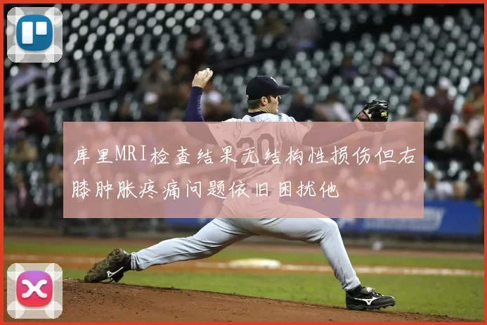库里MRI检查结果无结构性损伤但右膝肿胀疼痛问题依旧困扰他
